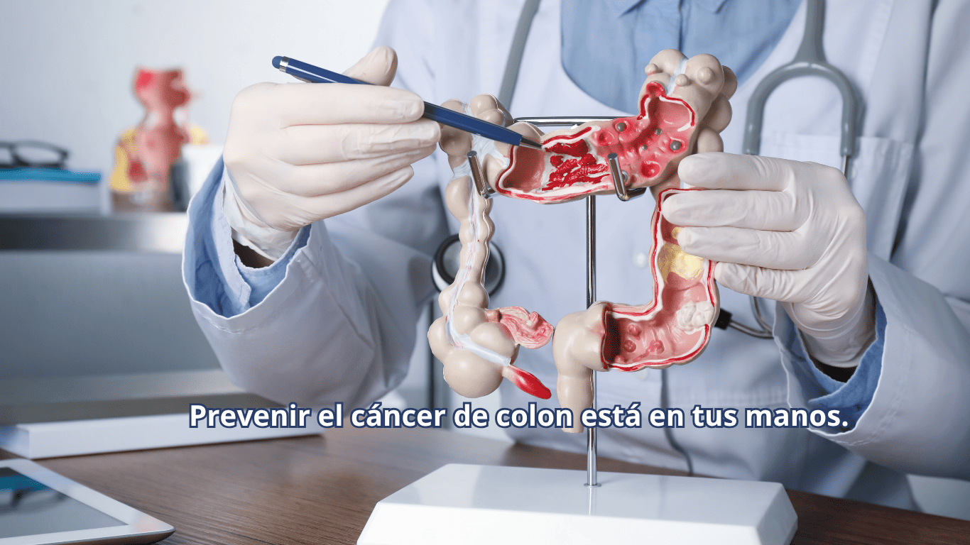 Día Mundial del Cáncer de Colon imagen novedad